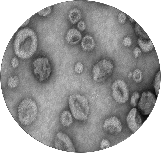Vesicule-excilone
